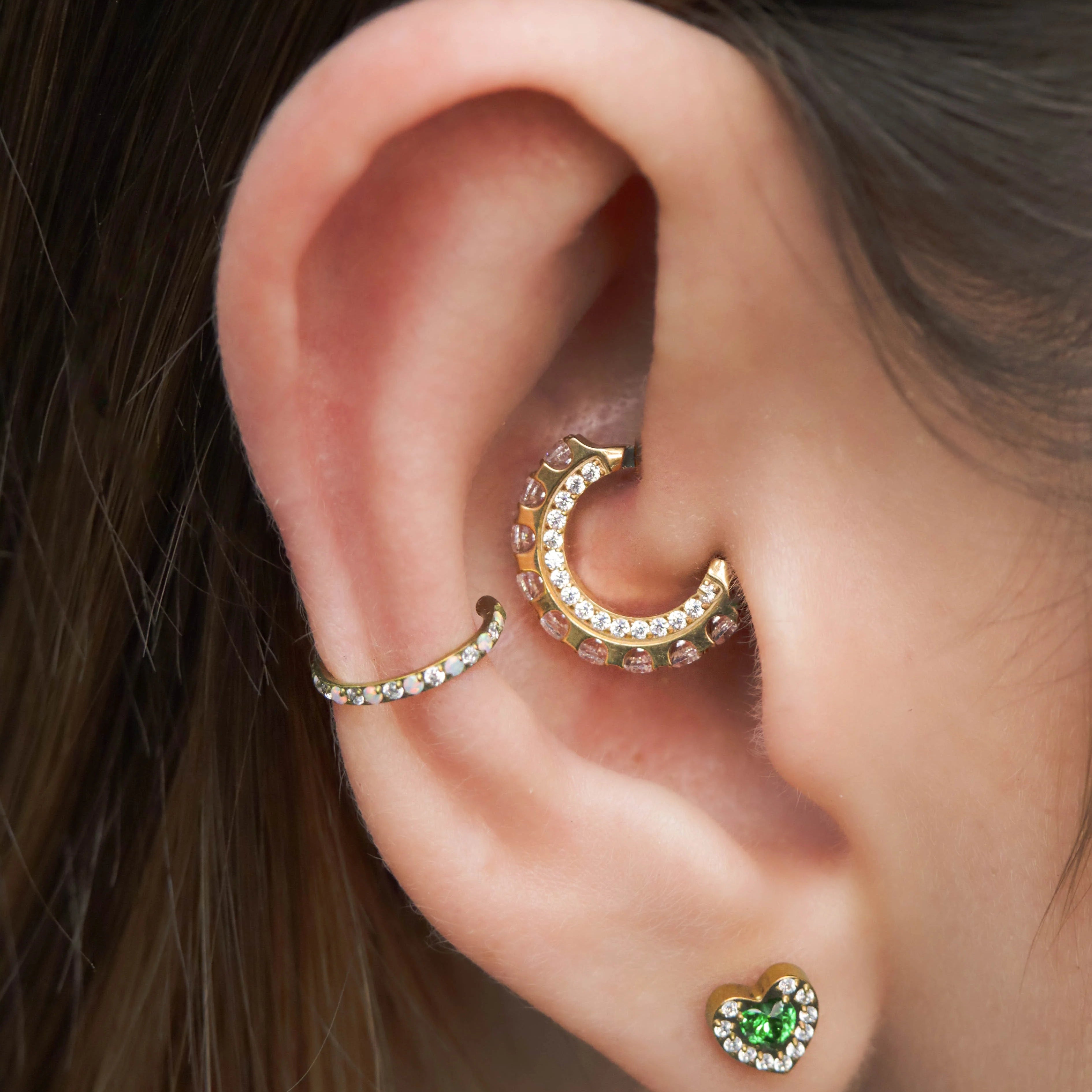 Aro Clicker Radiance · Titanio Grado Implante